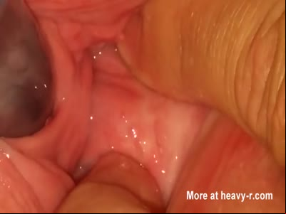 pictures of female pee hole sex archive